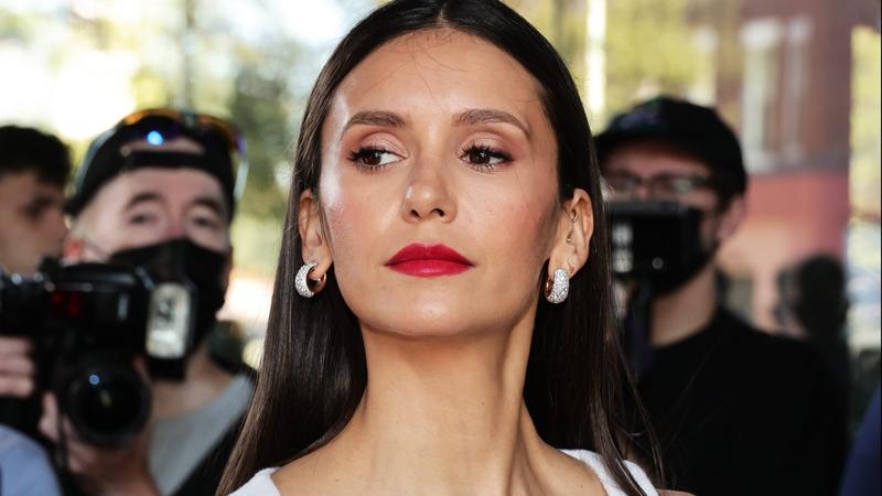 Nina Dobrev sikeres műtéten esett át motorbalesete után