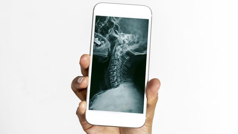 Úttörő képalkotó chip okostelefonokhoz, ami röntgenlátást ígér