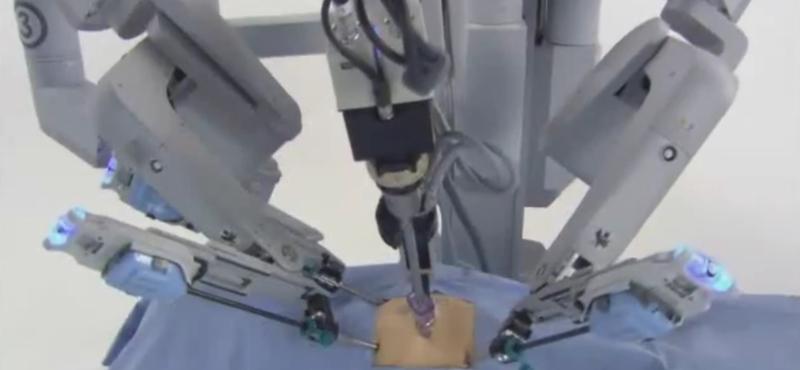 Orvos Rómából operált beteget Pekingben, sebészrobot segítségével