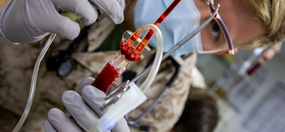 Forradalmi áttörés: A és B vércsoportok univerzális donorvérré alakíthatók