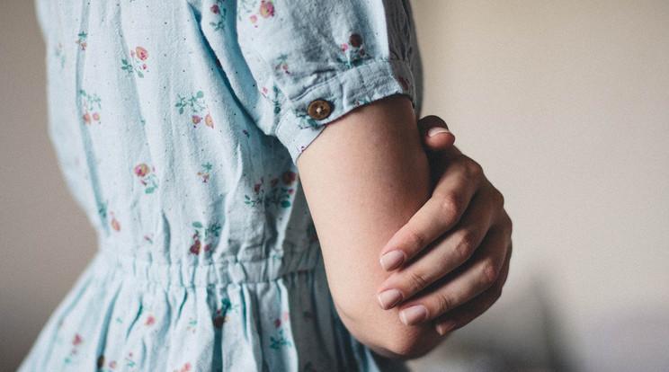 Átalakuló kezek: Egy nő férfi donortól kapott végtagok nőiessé válnak