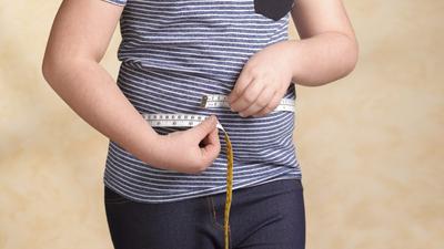 Gyermekkori elhízás: drámai hatás a várható élettartamra