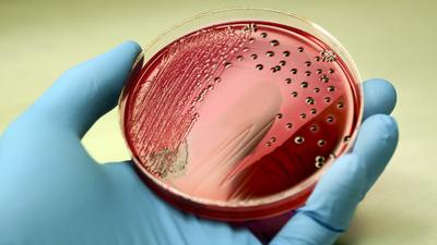Szalmonella-járvány terjed Amerikában fertőzött uborka miatt