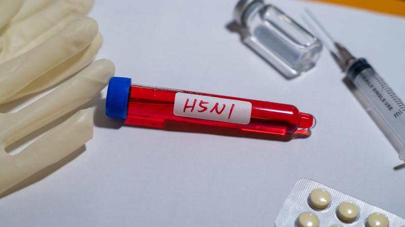 Az Egyesült Államok felkészül a madárinfluenza emberi járványának lehetőségére