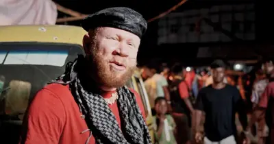 Aranyhal: A nigériai albínó színész, aki James Bond-főgonosz akar lenni