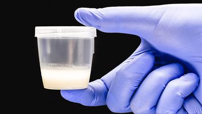 Mikroműanyagok a spermában: aggodalomra ad okot a legújabb kutatás