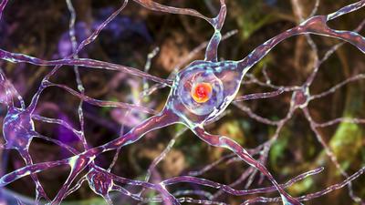 Tudósok megfejtették a ritka SCA4 neurológiai betegség genetikai okát
